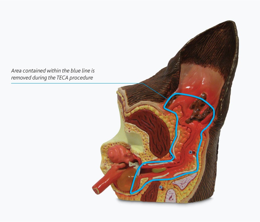 total-ear-canal-ablation-surgery-diagram