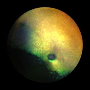 An eye image taken using a fundus camera