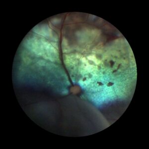 An eye image taken using a fundus camera