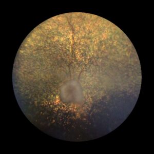 An eye image taken using a fundus camera